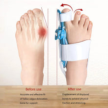 bunion valgus protective cover